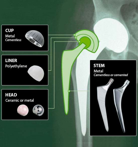 Radiografia-hip